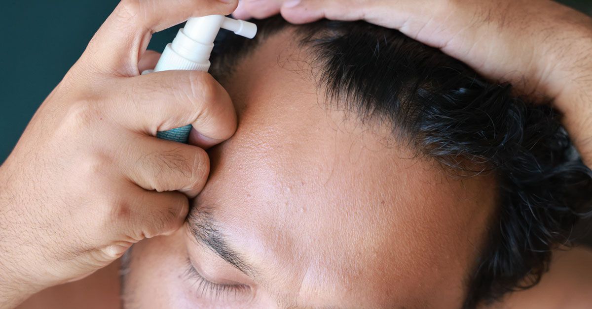 FDA Issues Warning on Hair-Loss Product Finasteride, Citing Side Effects